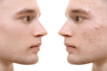 skincenter_gr_new_derma_ypiresies_eidikes_dermatopatheies_3_476x315