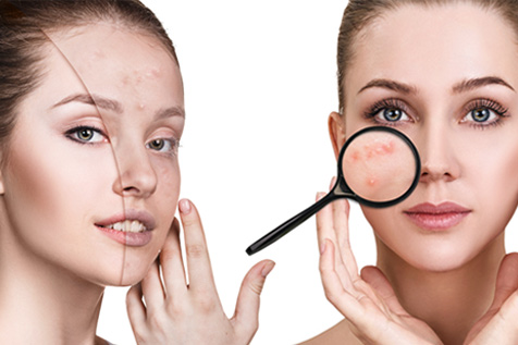 derma-skin-center-therapeftiko-lazer-therapeia-akmis-thumb